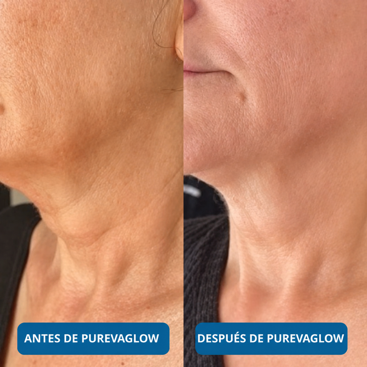 Sérum Ultra Hidratante con 3% de Ácido Hialurónico de PurevaGlow (30 Ampollas)