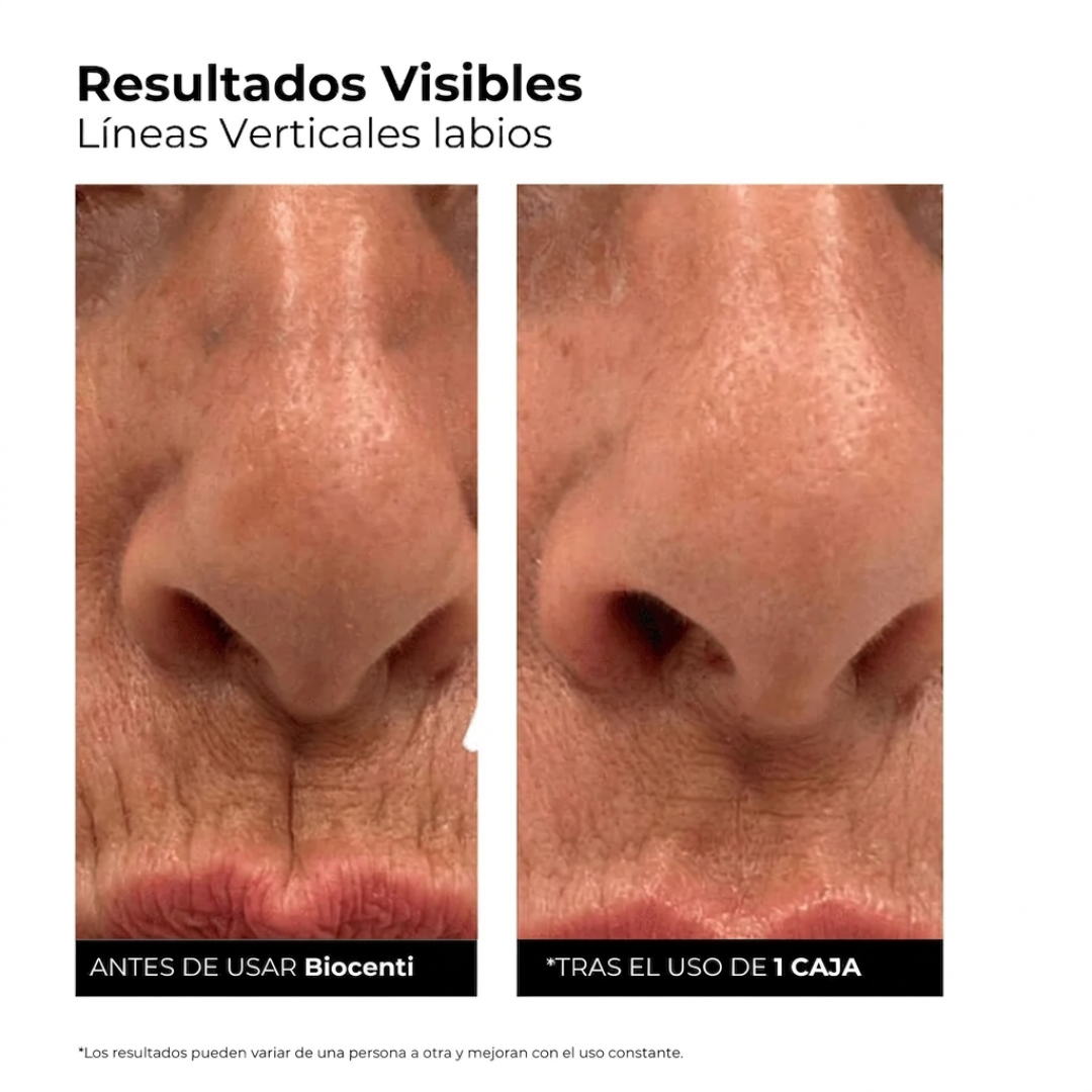 Sérum Ultra Hidratante con 3% de Ácido Hialurónico de PurevaGlow (30 Ampollas)