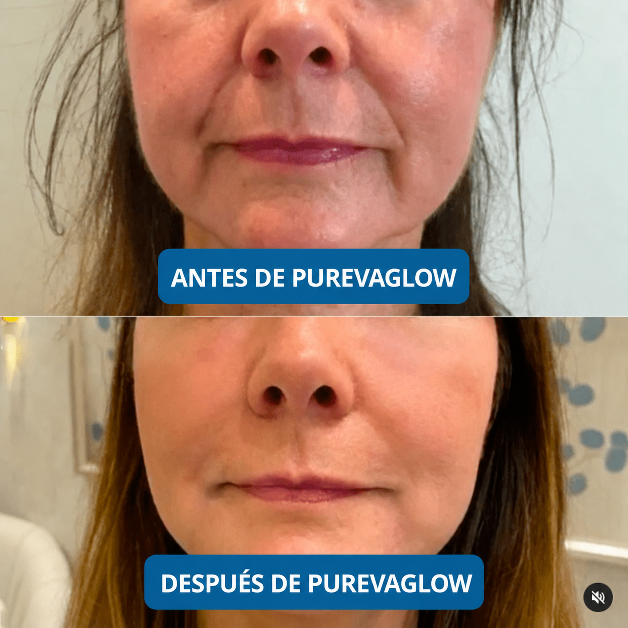 Sérum Ultra Hidratante con 3% de Ácido Hialurónico de PurevaGlow (30 Ampollas)