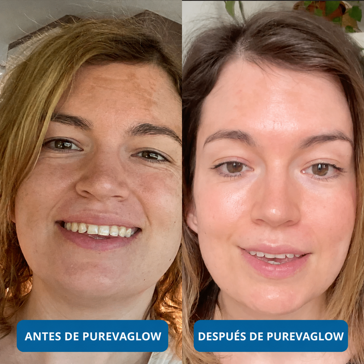 Sérum Ultra Hidratante con 3% de Ácido Hialurónico de PurevaGlow (30 Ampollas)